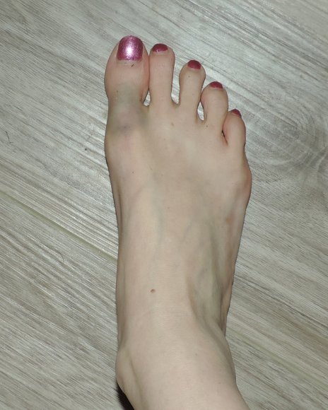 toe