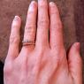 65 ring fixed