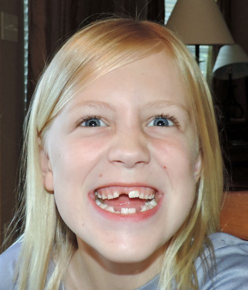 30 hannah no teeth