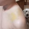 10 collarbone